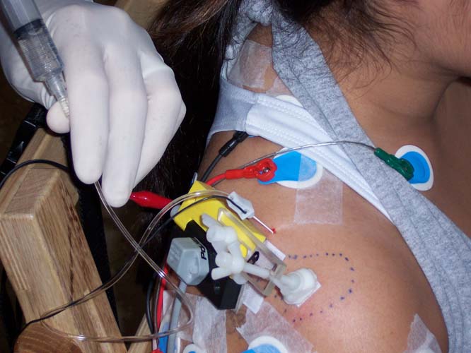 2_nerve_block 