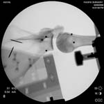 6_fluoro2