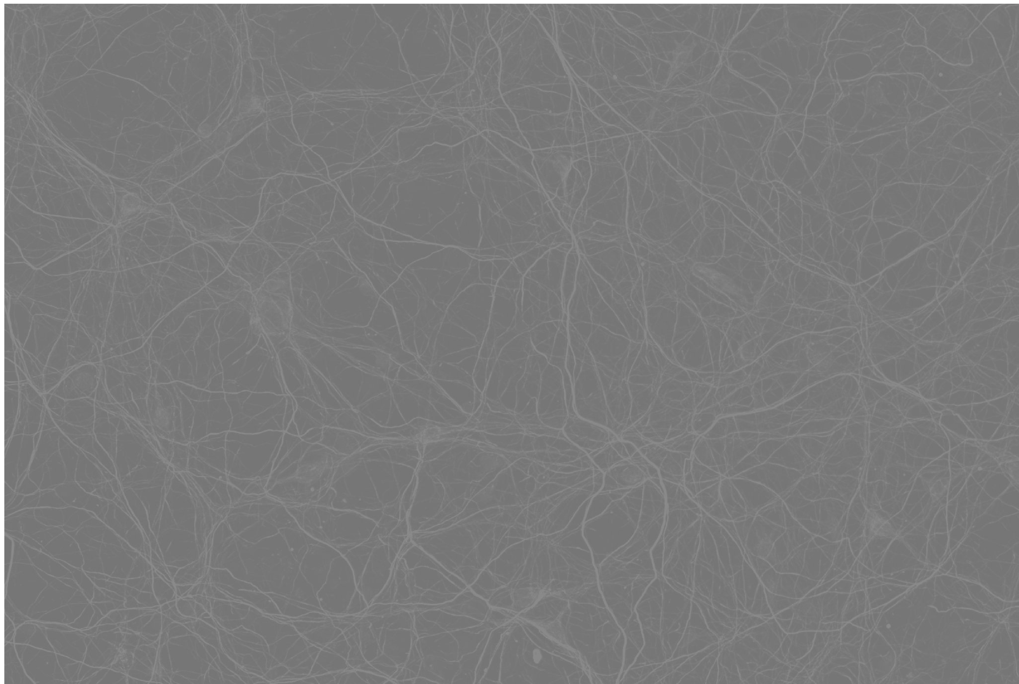 neurofilament staining