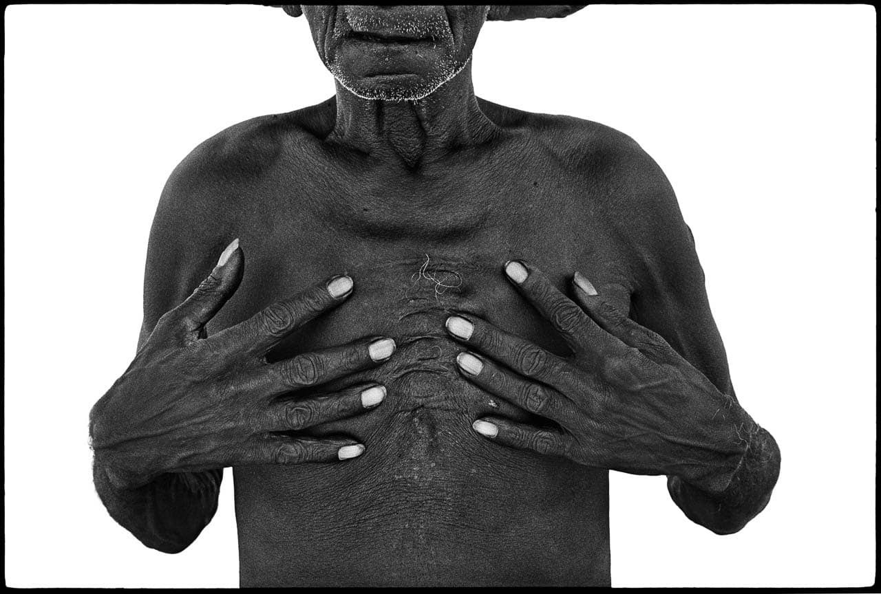 Photograph of a dark-skinned person from the mouth to ribcage. Their hands are held against their chest. The contrast between their light fingernails and dark skin is stark.