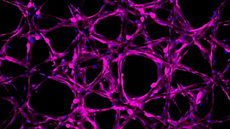Purple and black close-up of hydrogel inside polycaprolactone mesh tube