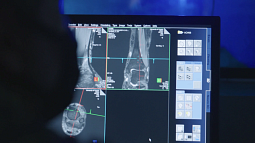 Computer screen with biomechanical imaging program on screen