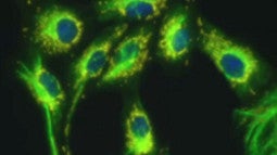 Scientific image scan in green and blue