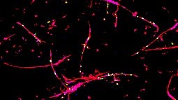 blood vessels grown in a petri dish, in lab. shown as red and pink filaments against a black background. 