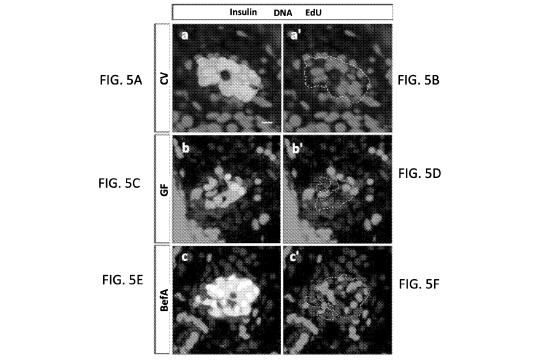 A series of panels showing the effect of BefA on β cell proliferation.