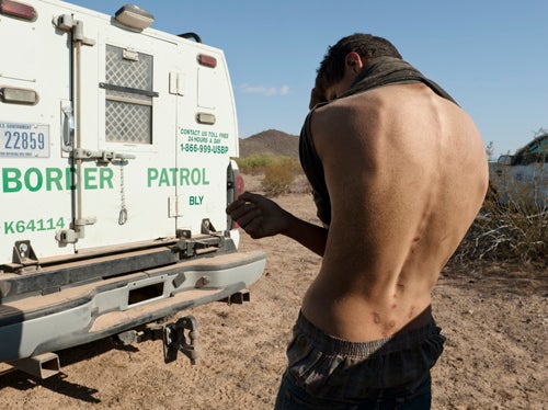 Backpack Scars, Arizona Backpack Scars, Arizona.