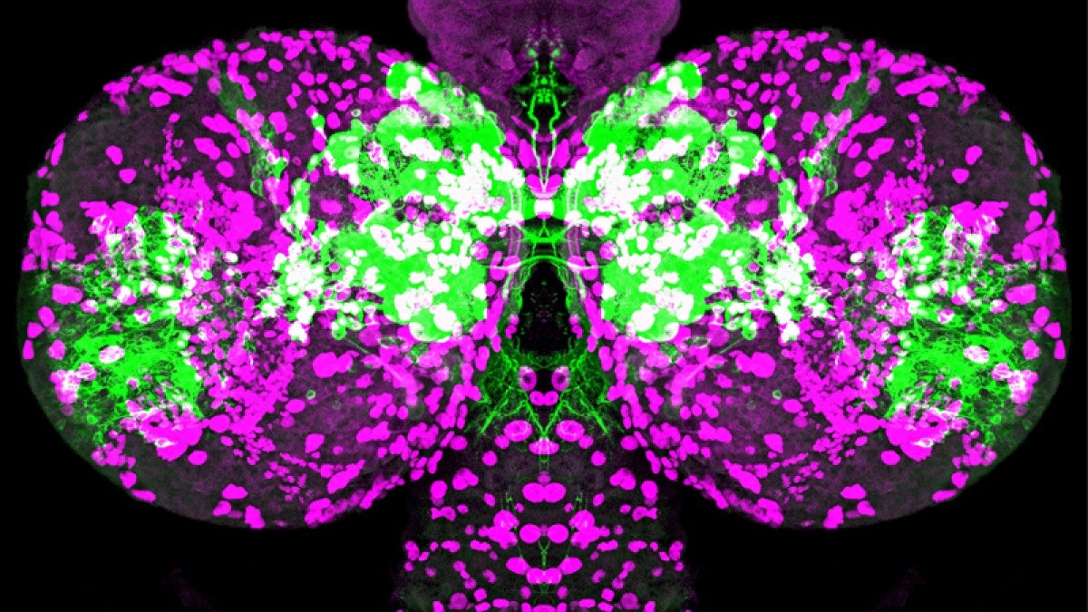 Image shows the over-production of unnecessary cells when a key hormone is blocked during brain development in a fruit fly