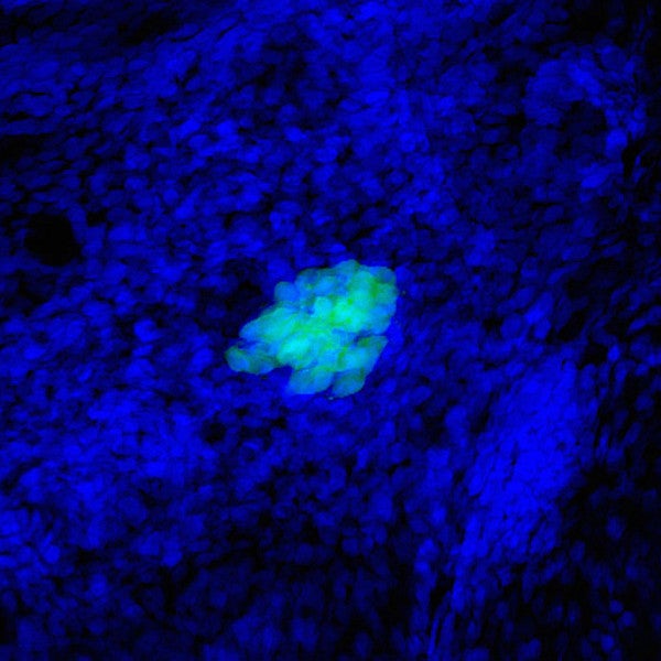 ZF Beta Cells