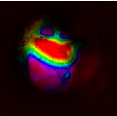 Wide-field imaging captures levels of activity across a mouse brain