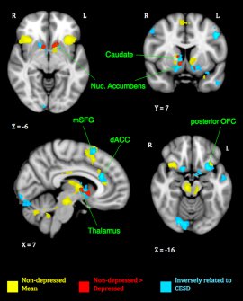 image shows brain scans from the study