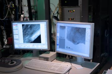 Two computer screens show microscope images on them in black and white.