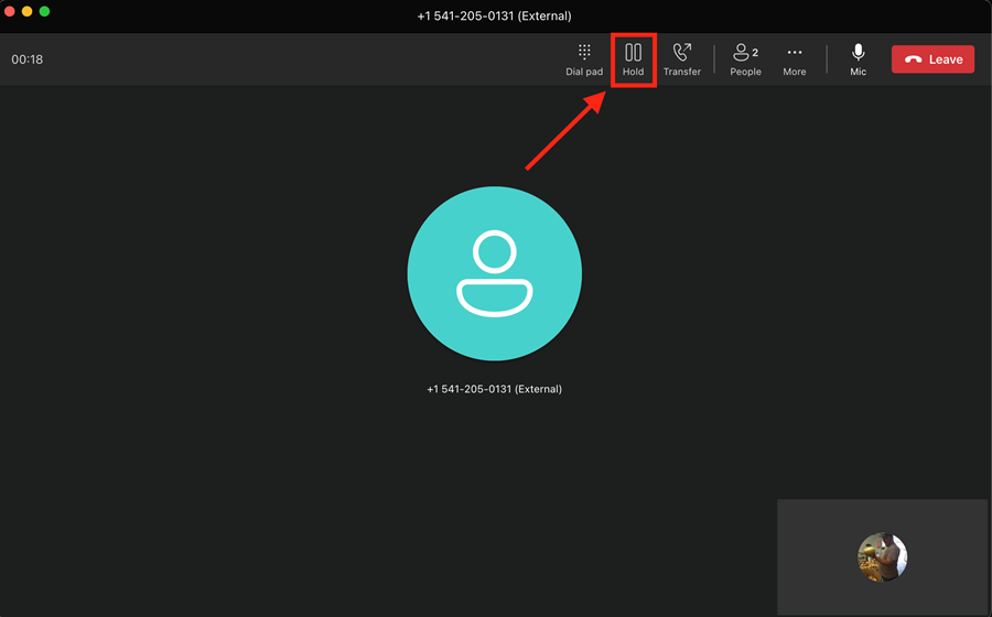 Hold button in call window